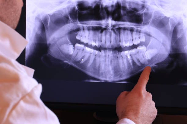 Best Urgent Tooth Repair  in Bloomingdale, TN